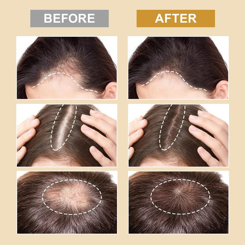 PURC Biotin Hair Growth Products for Men & Women